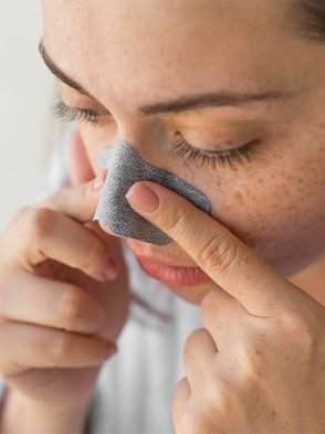 Cravos no nariz: dicas para evitar e remover